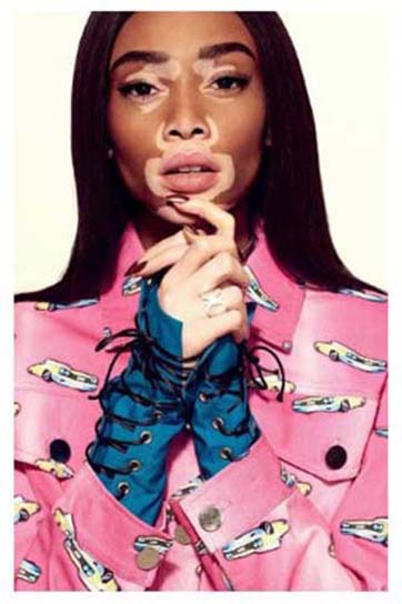 Winnie Harlow Model\Activist